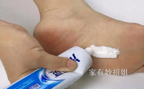睡前牙膏涂脚底，作用太厉害了