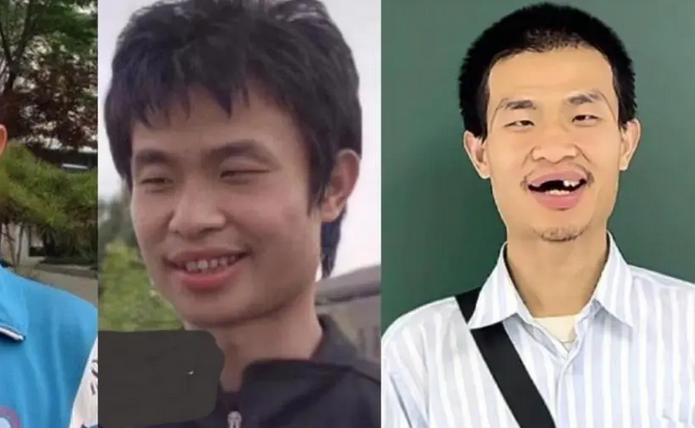 韦东奕，曝光的不只是健康问题