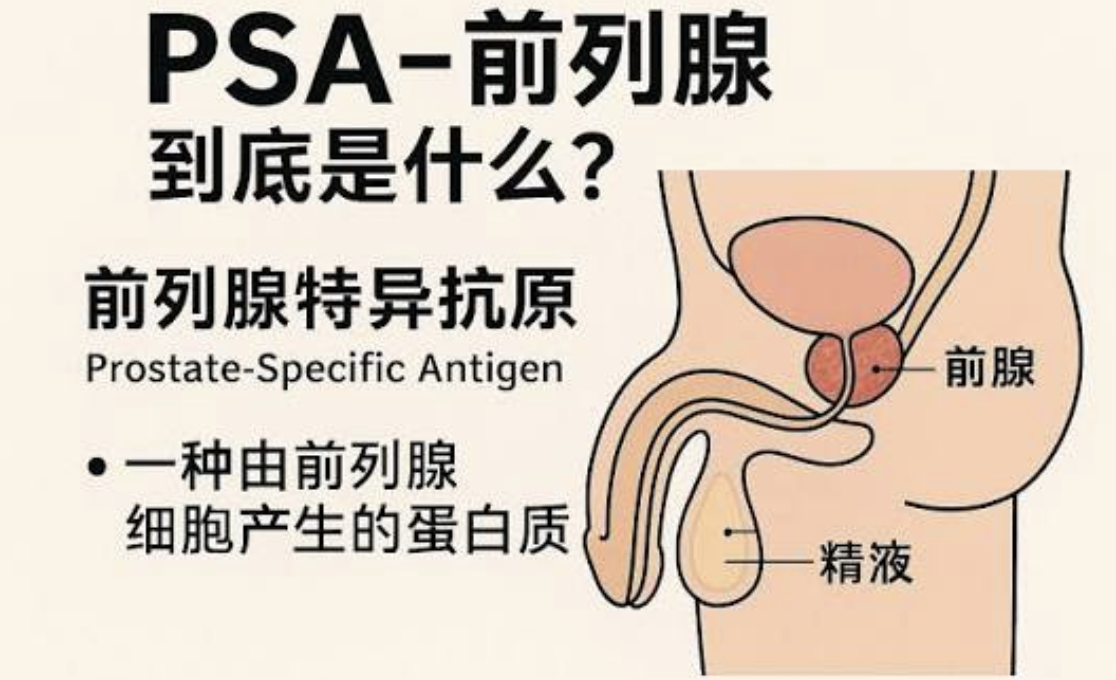 男人过70岁，前列腺PSA检查